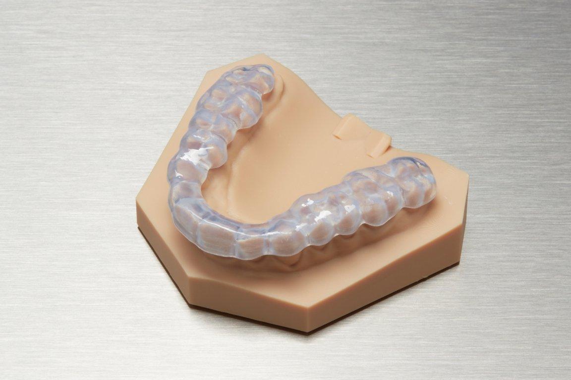Fertige Okklusionsschiene aus Dental LT Clear Resin auf einem Diagnosemodell.