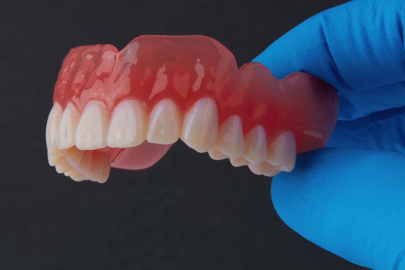 Blue gloved fingers holding a 3D printed denture.