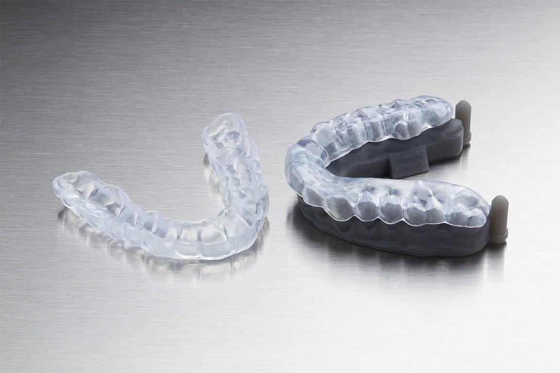 Gouttière occlusale imprimée en Dental LT Clear Resin, sur un modèle de diagnostic.