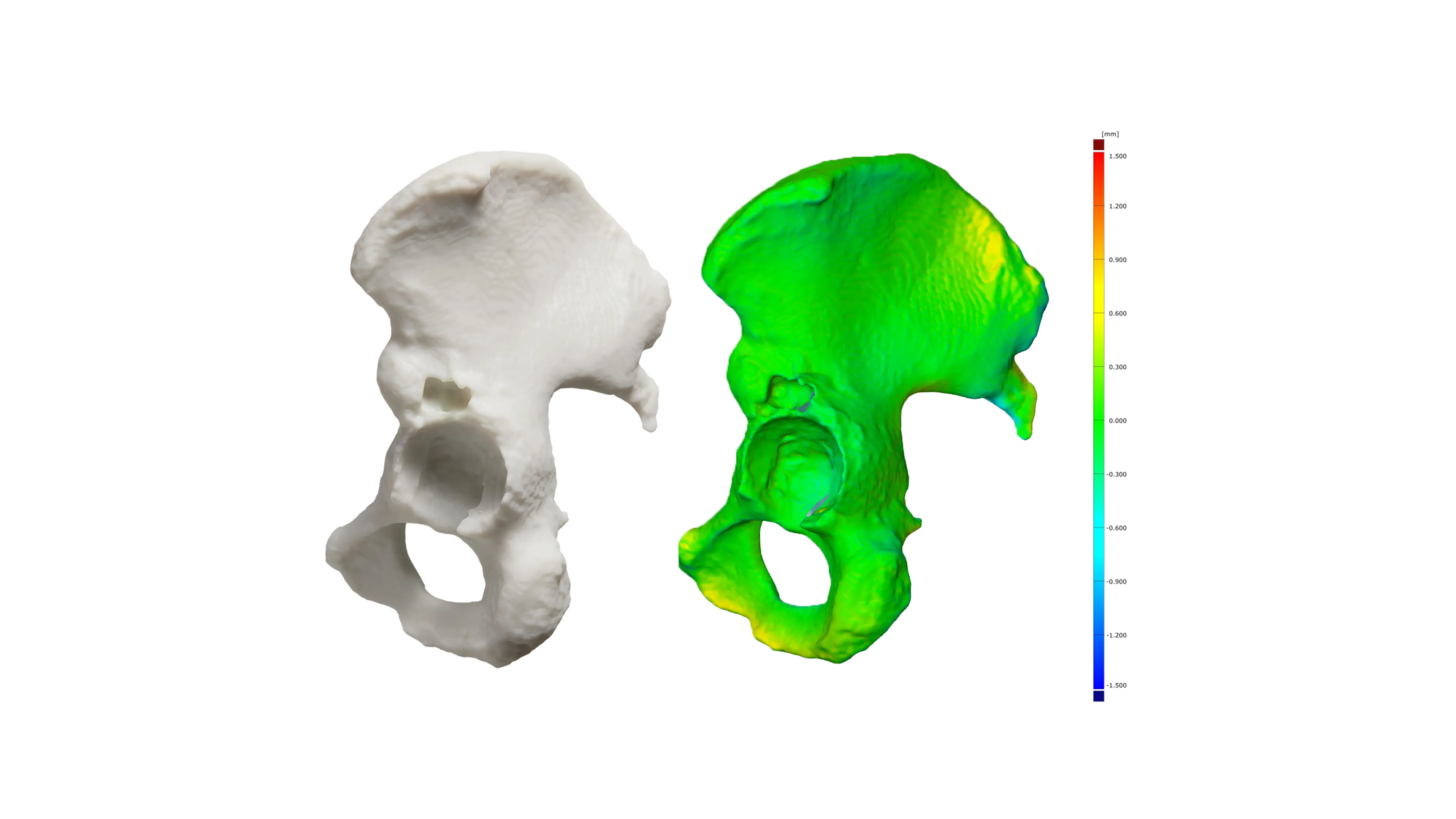 Os iliaque anatomique imprimé en 3D