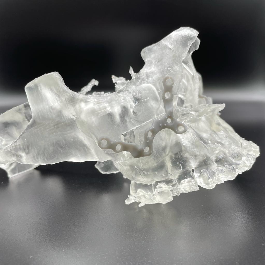 Clear 3D printed anatomical model of an upper jaw.