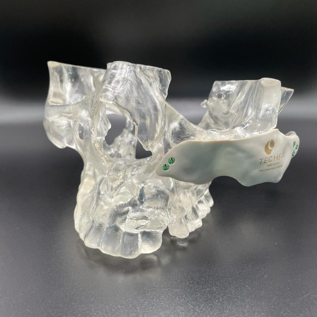 Clear 3D printed midsection of a skull with a fitted plate