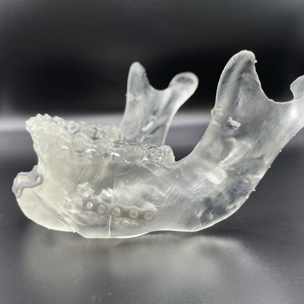 Clear, 3D printed anatomical model of a lower jaw