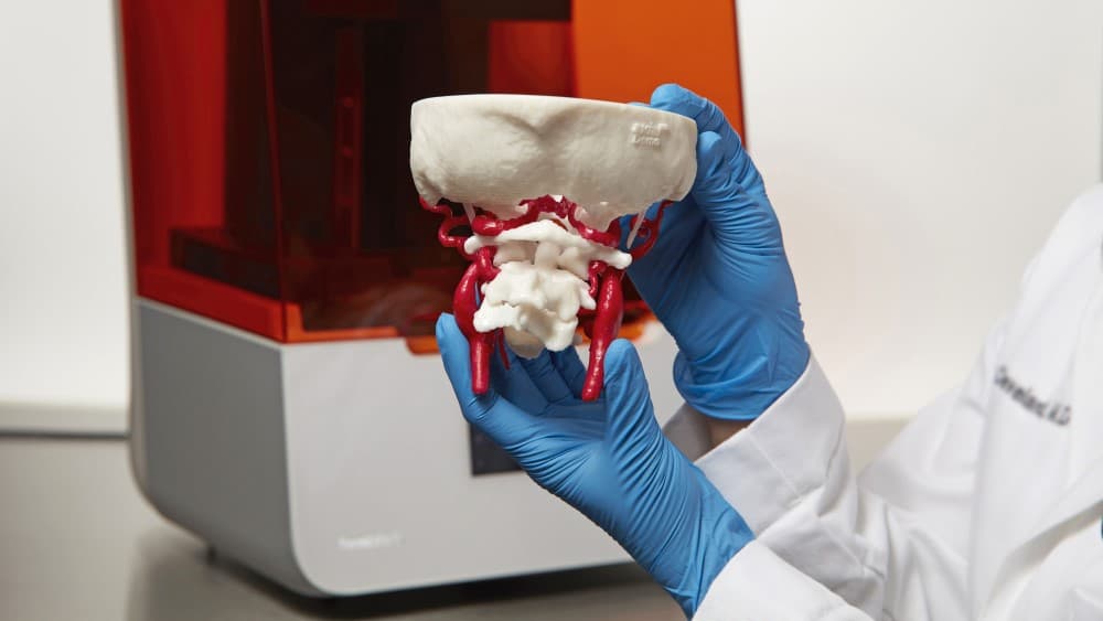 3D Printing in the Hospital