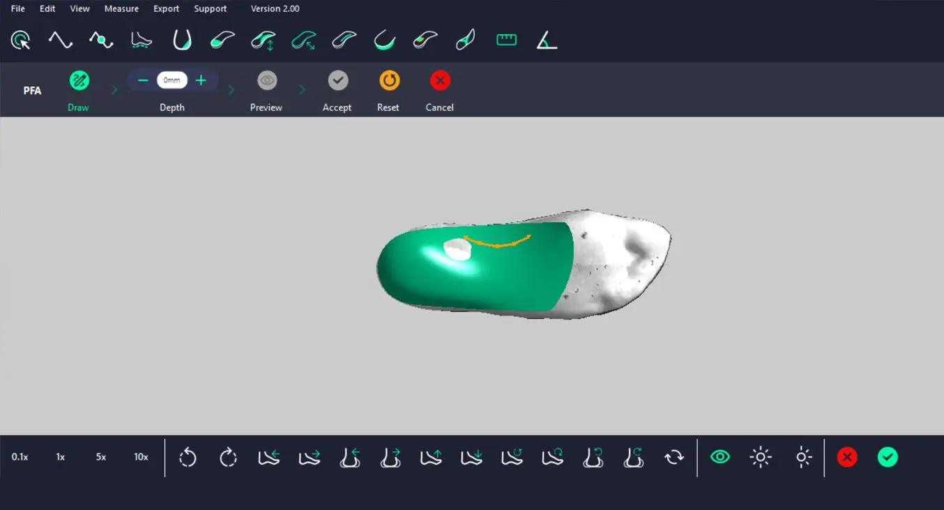 Screenshot of LaserCAM software of a rigid insole being designed