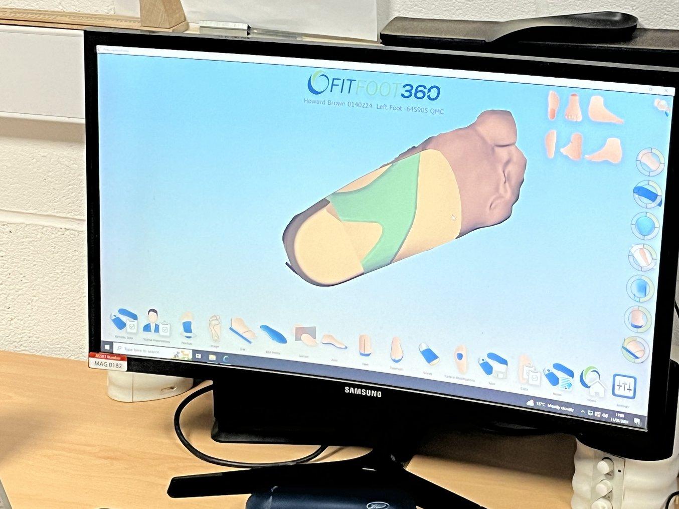 Computer screen showing FitFoot360 orthotic software