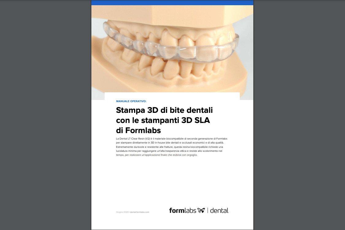 Stampa 3D di bite dentali con le stampanti 3D SLA di Formlabs