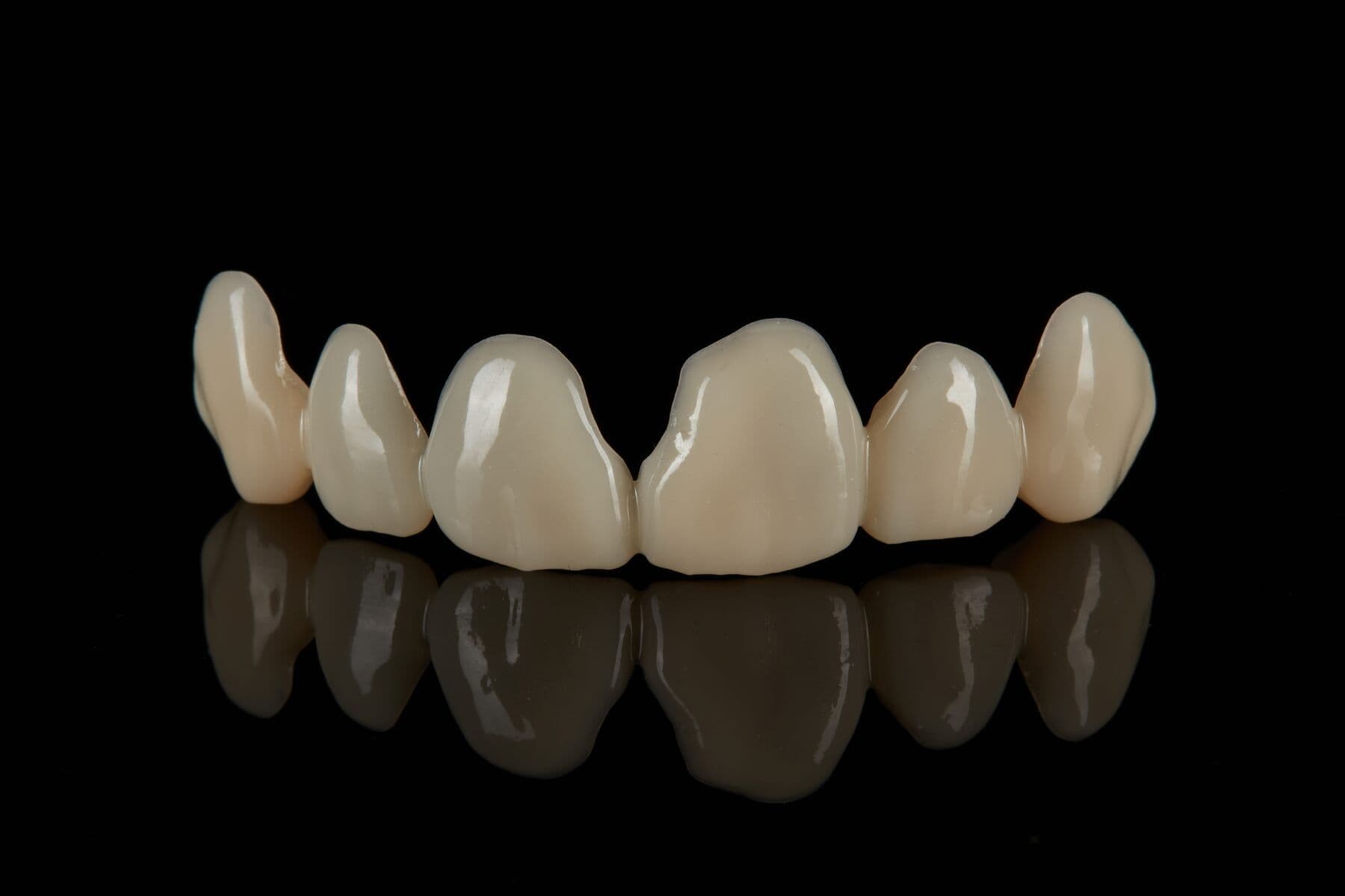 Bego Varseosmile TriniQ Resin