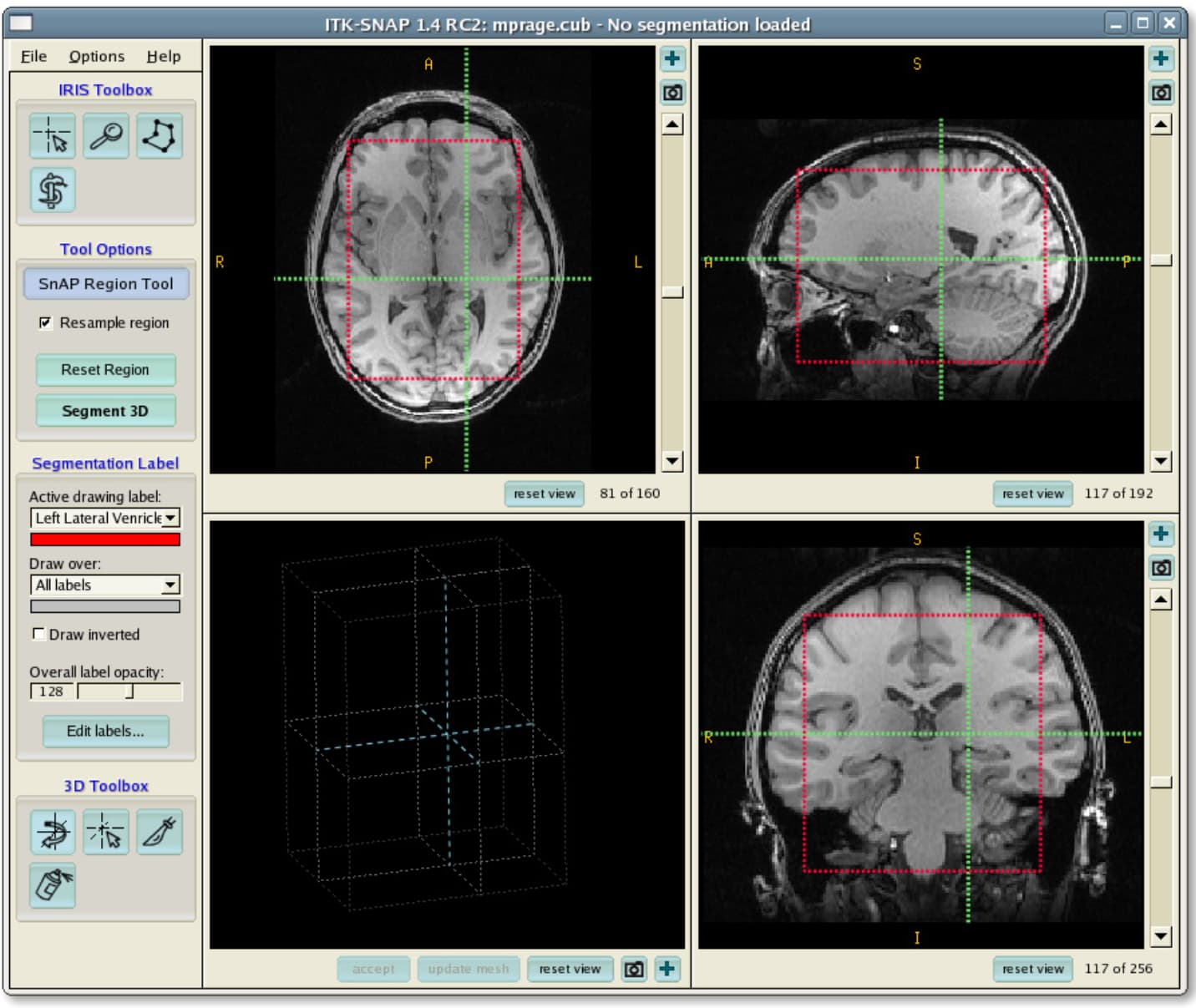 screenshot of the ITK-Snap software, showing head scans
