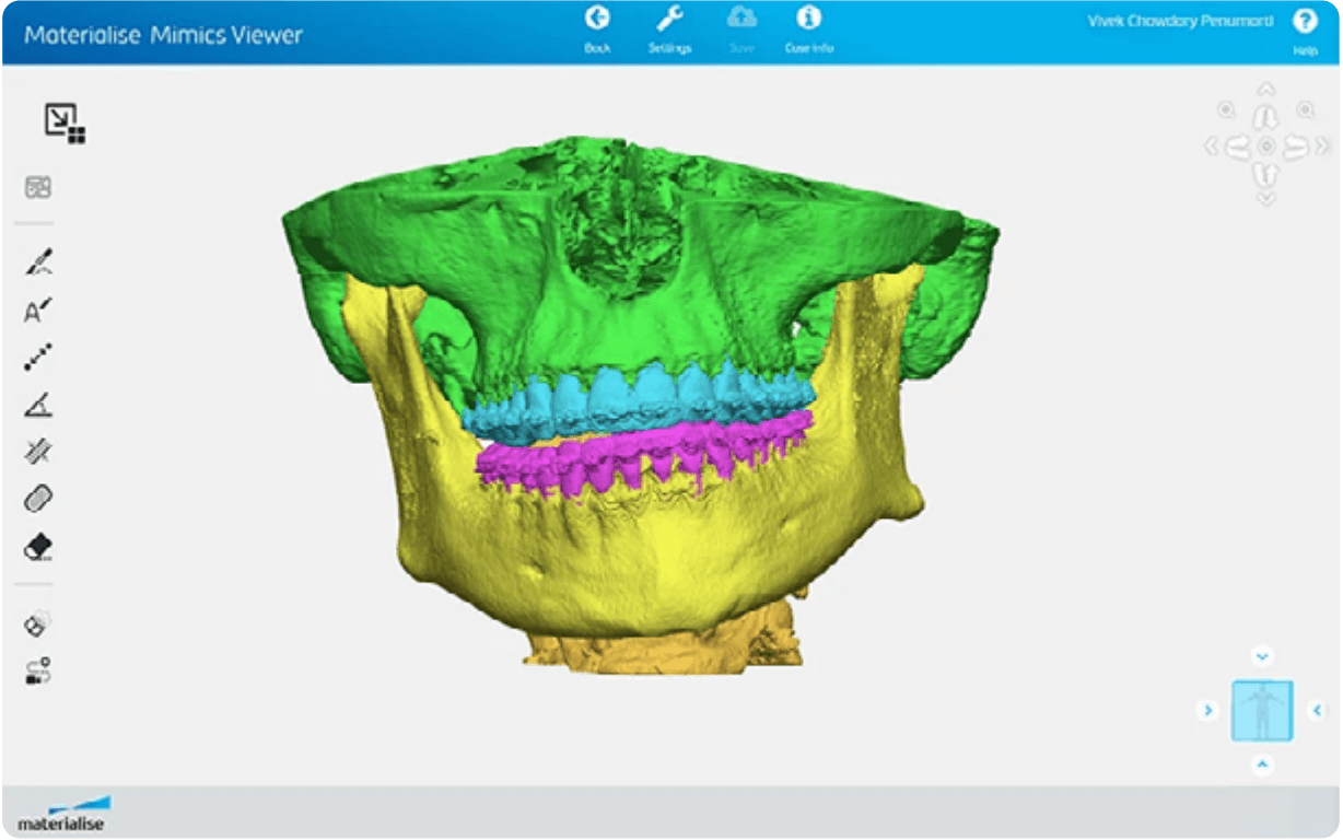 materialise mimics innovation