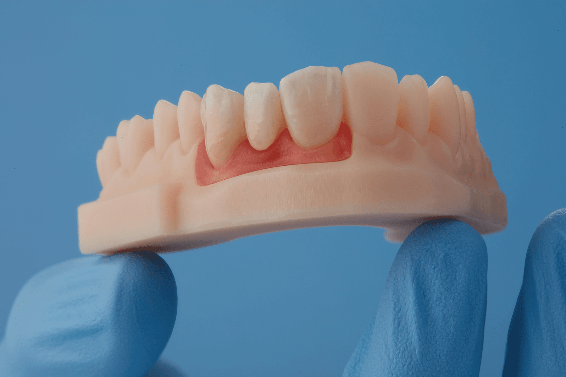 Soft tissue with dental models