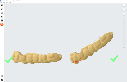 PreFormで方向付けされたオフセットタイプのアプライアンス
