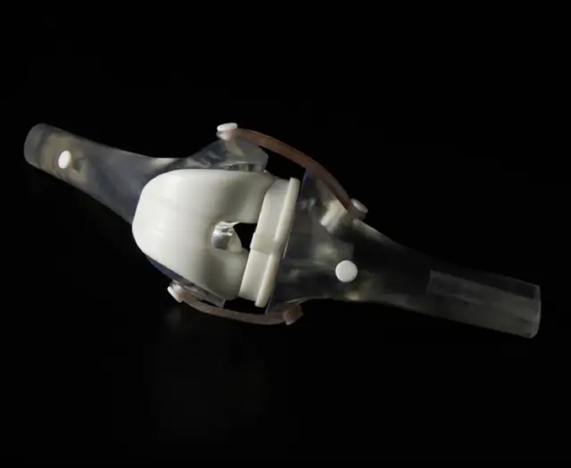 3D printed model of a joint in clear and white resins