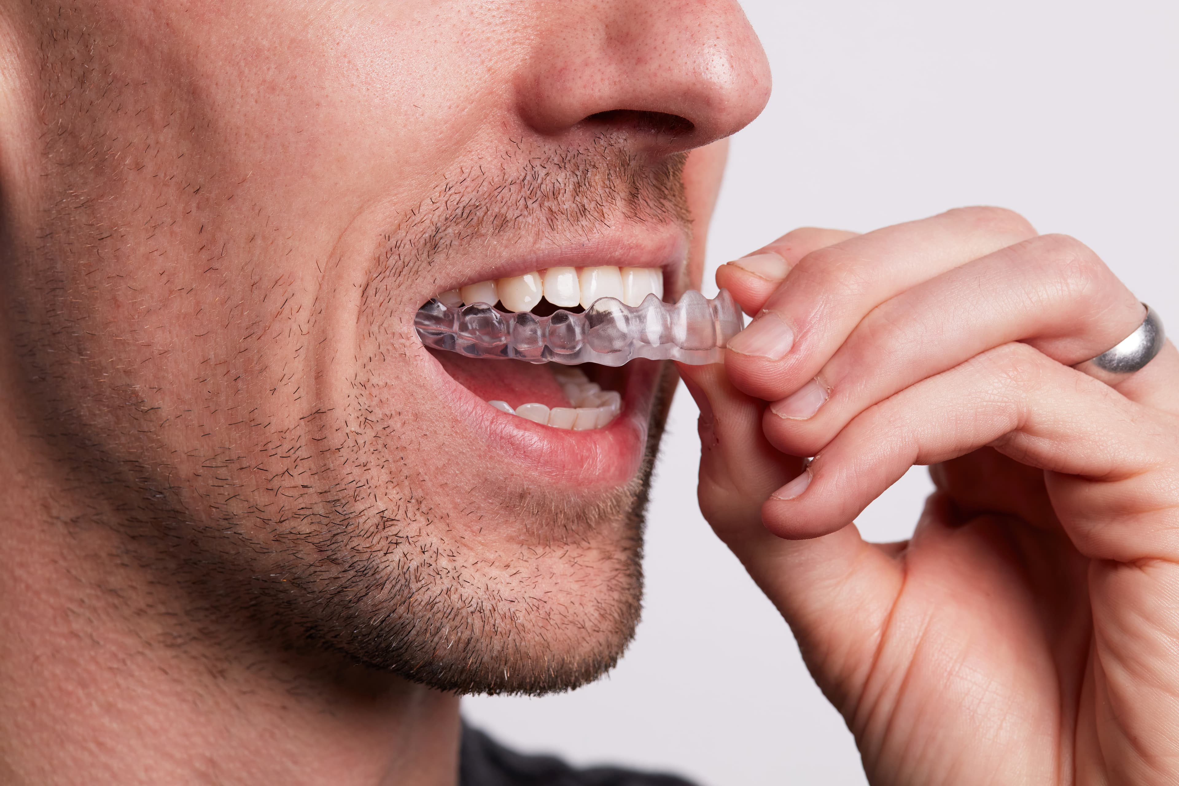 Dental LT Comfort Occlusal Guards