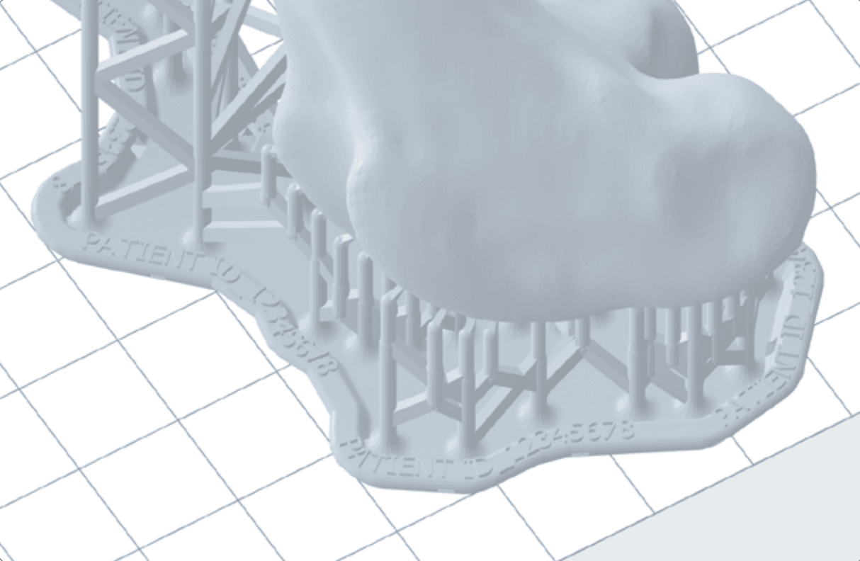 raft of a patient-specific model