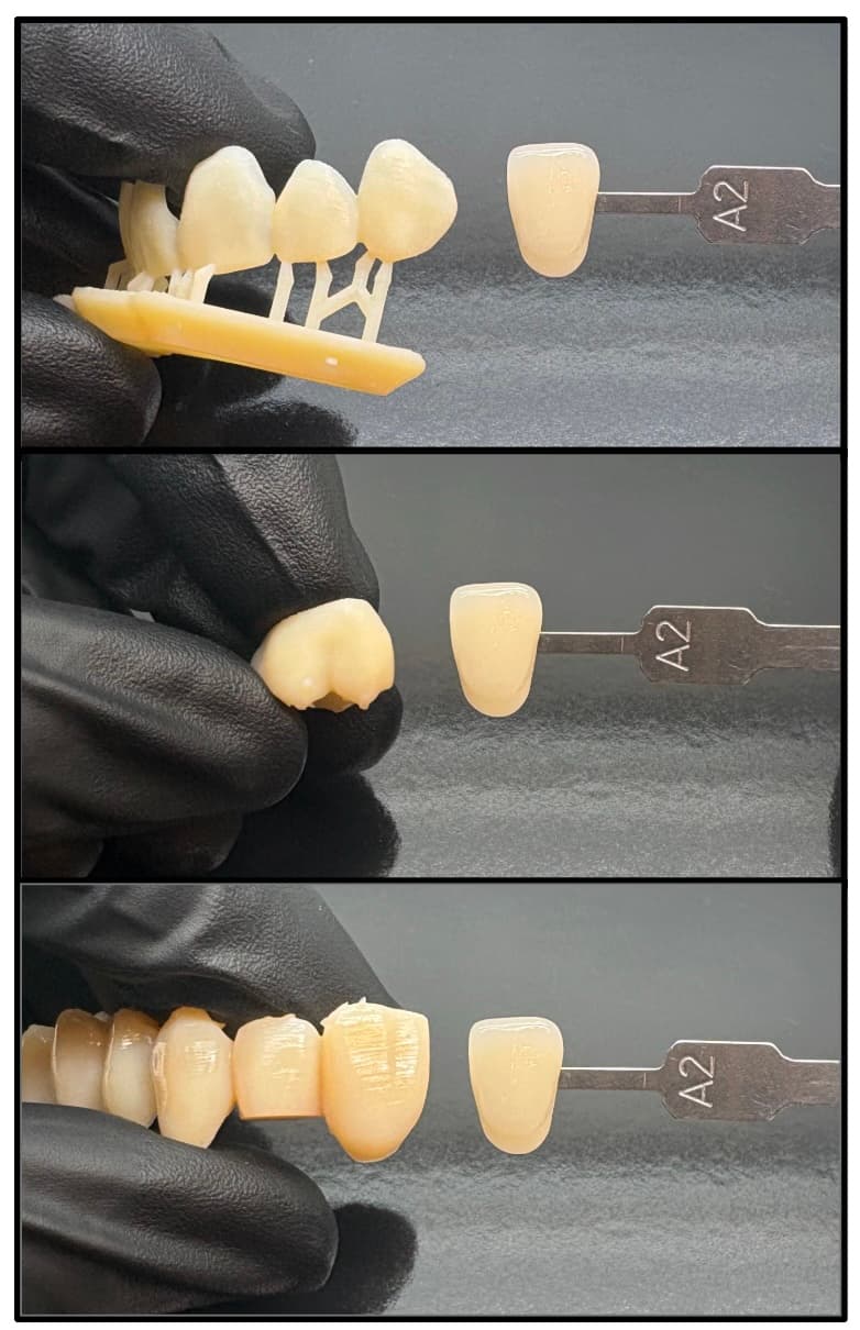 Impact of thickness on Premium Teeth Resin color
