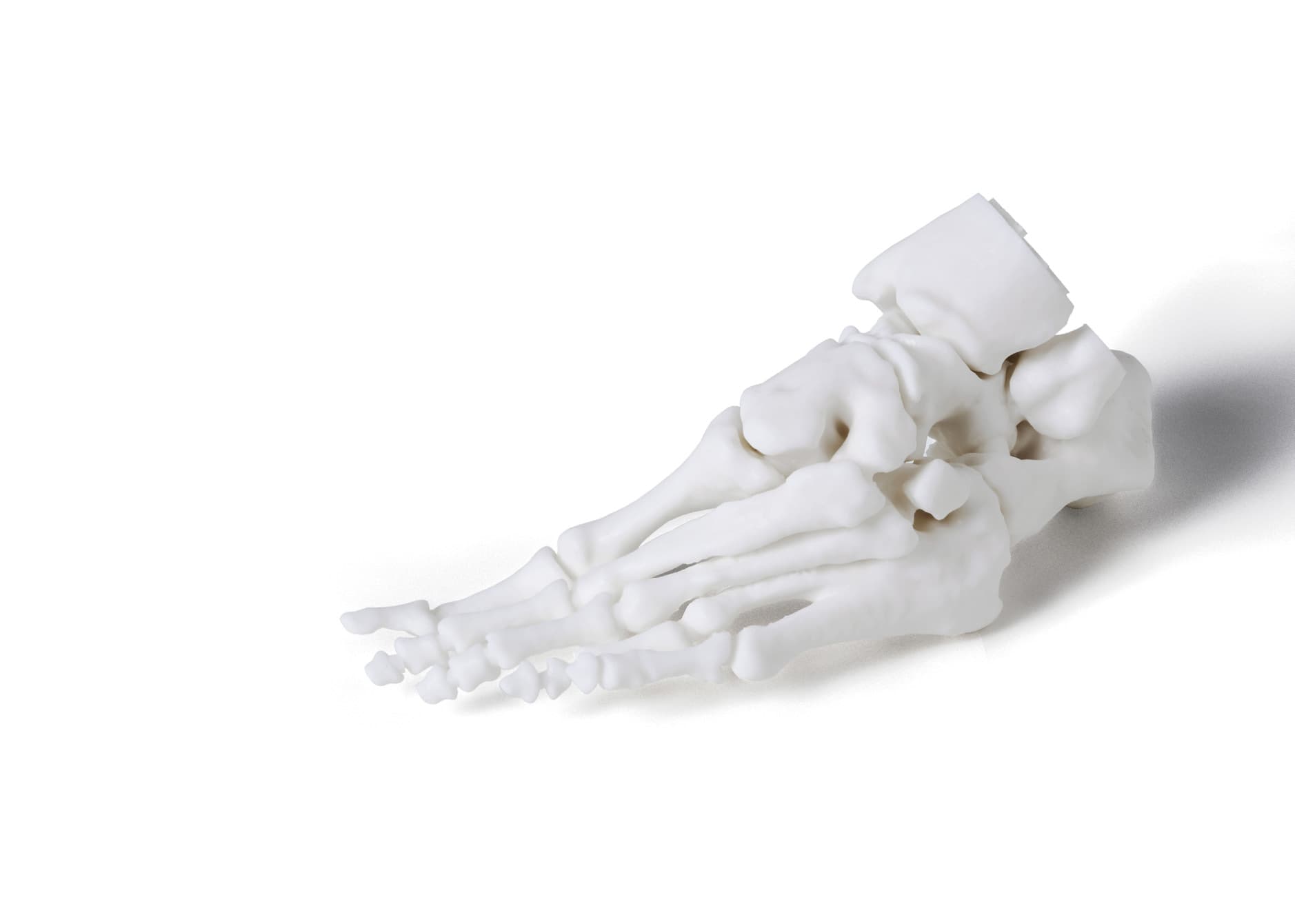 3D printed anatomical bone model