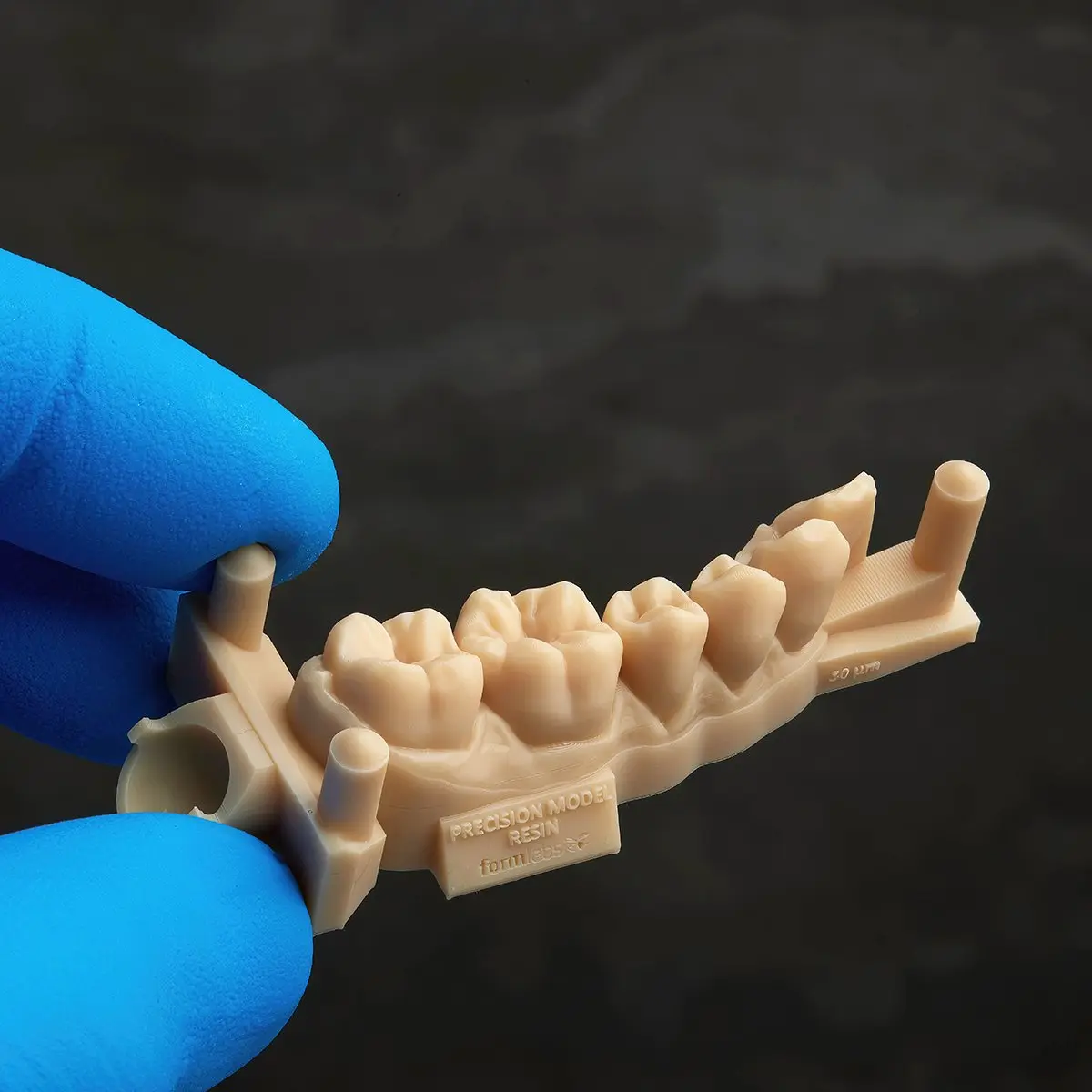Guías para restauraciones impresas en 3D
