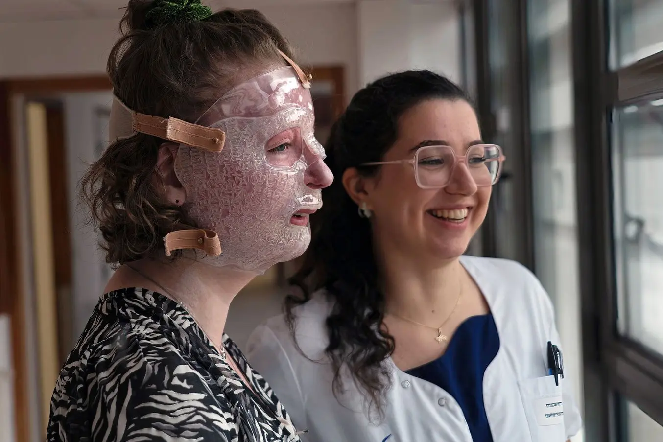 Una paziente con gravi ustioni indossa una maschera facciale realizzata tramite stampa 3D.