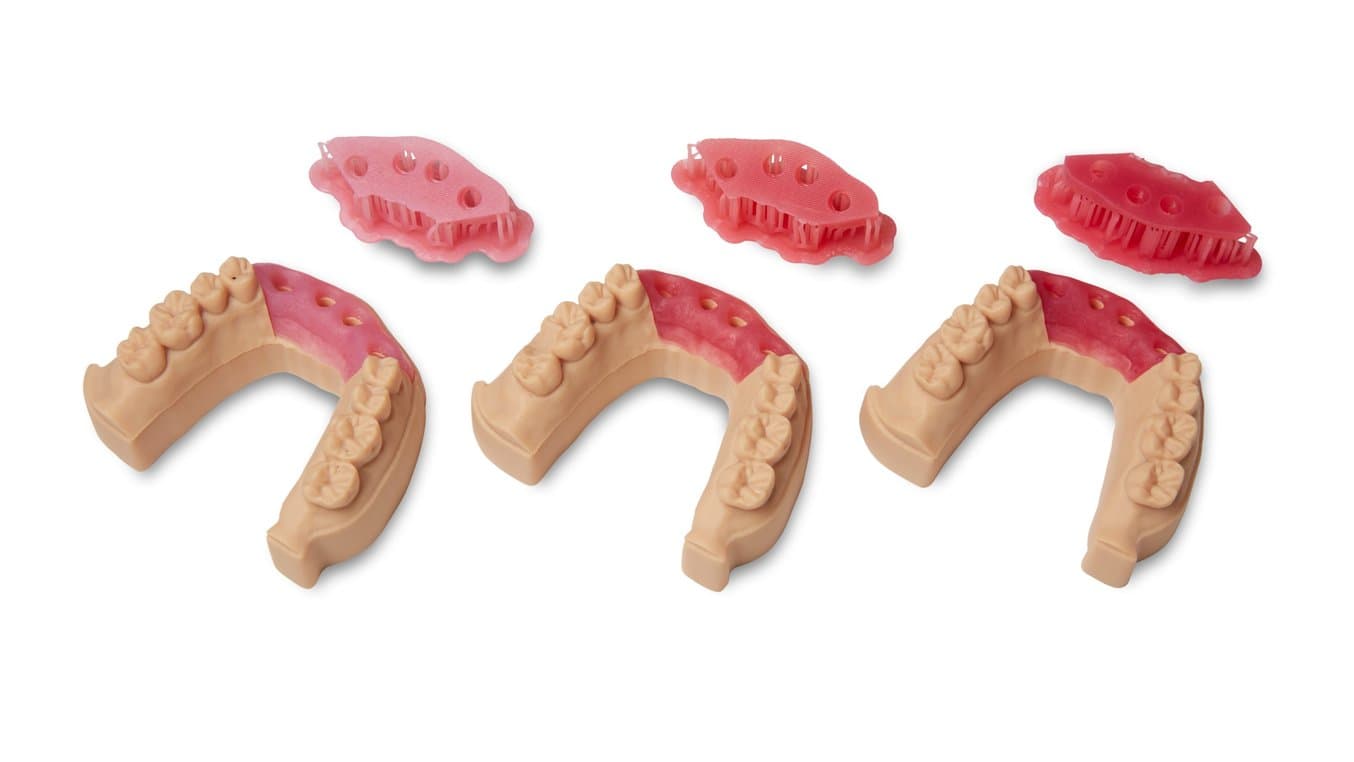 Modelos de implantes impresos con la Model Resin. Las máscaras gingivales se imprimieron en tonos rosa oscuro, medio y claro de la Soft Tissue Resin.