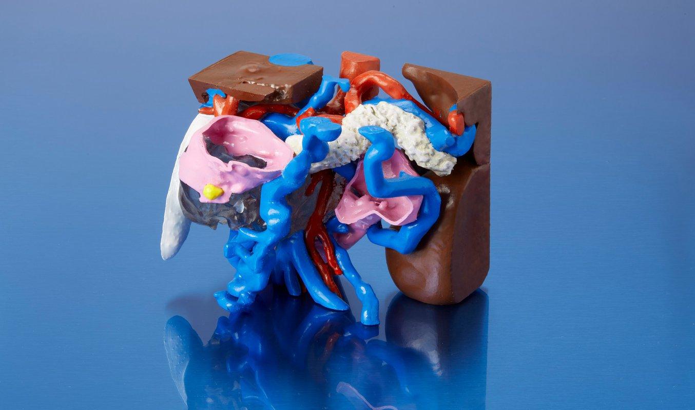 SLA方式3Dプリンタで制作し、アクリル塗料で塗装したフルカラーの膵臓模型。