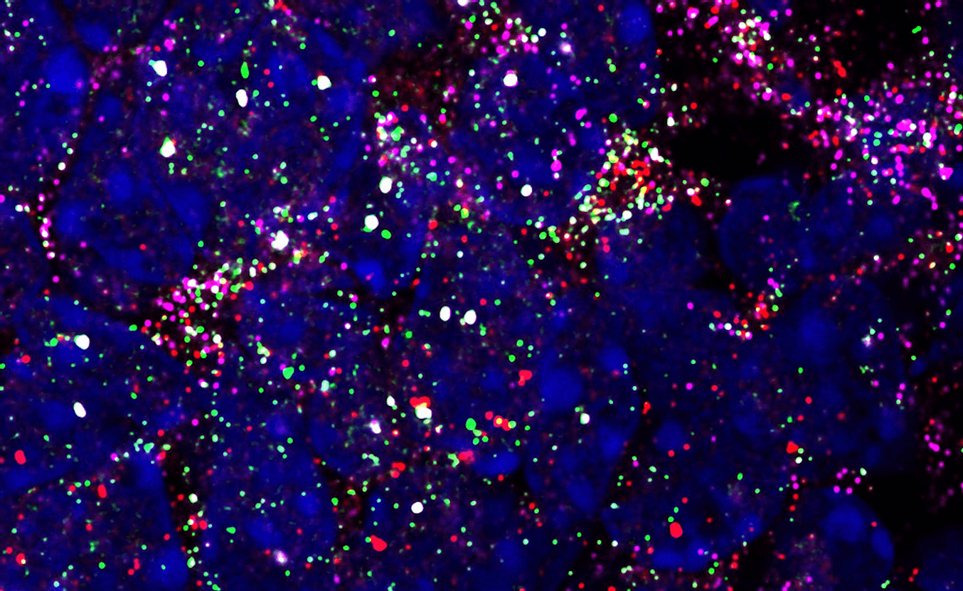 The molecular chip contains multiple labeled probes and can recognize up to 7 different genes in a single reaction.The different types of color combinations are used as barcodes, which can then be read under the microscope, or Pixelbio's AI-driven software