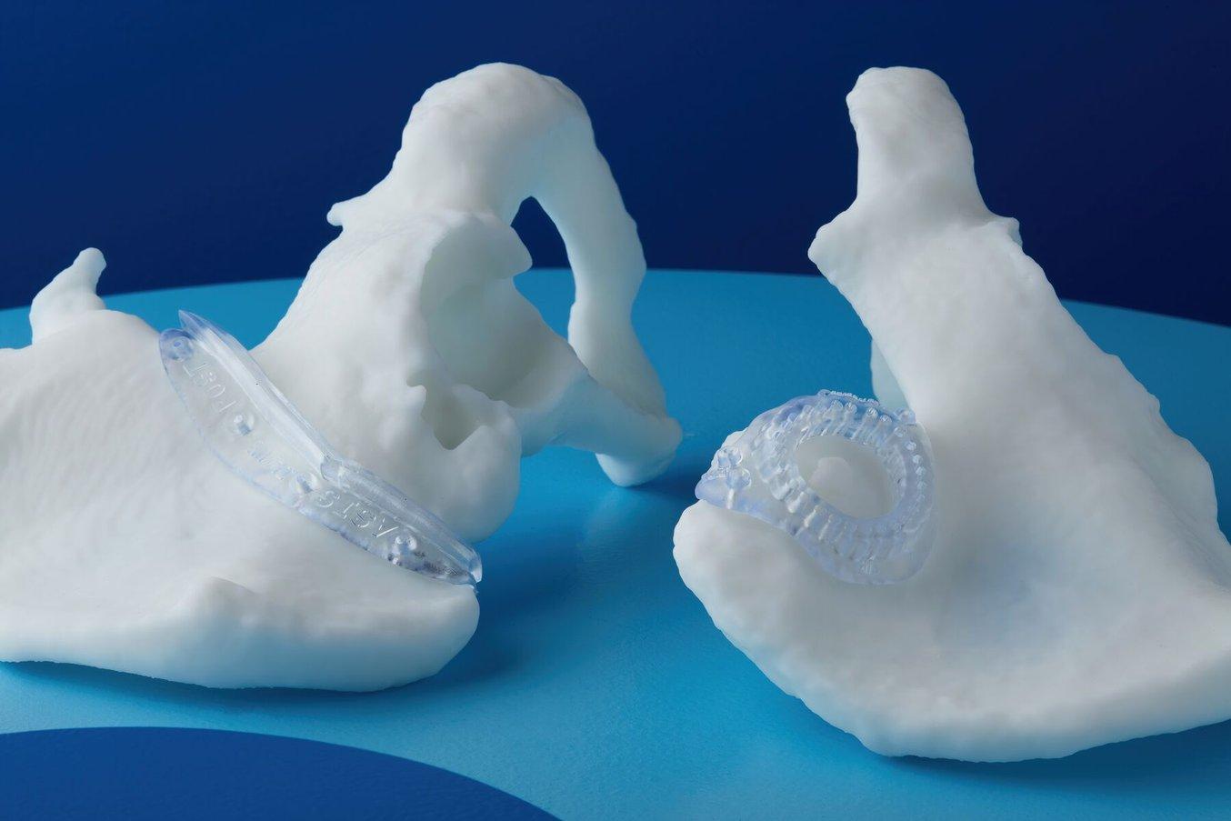 3D printed surgical guides in white resin