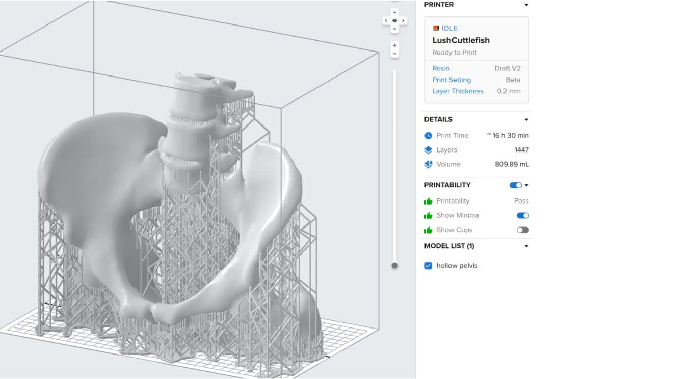 Tough 1500 Resin - Certified for skin contact - 3D printing