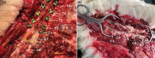 spine prior to laminectomy cuts