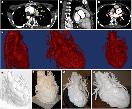 Views of the computed tomography imaging dataset and white 3D printed models