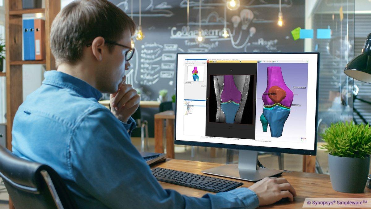 man looks at a computer monitor with an image of a knee joint