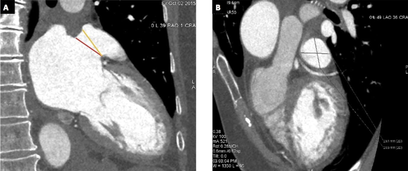 CCT measures with indications