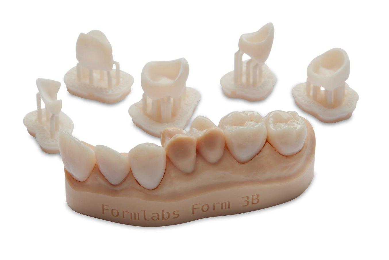Примеры единичных реставраций, изготовленных из Permanent Crown Resin методом 3D-печати