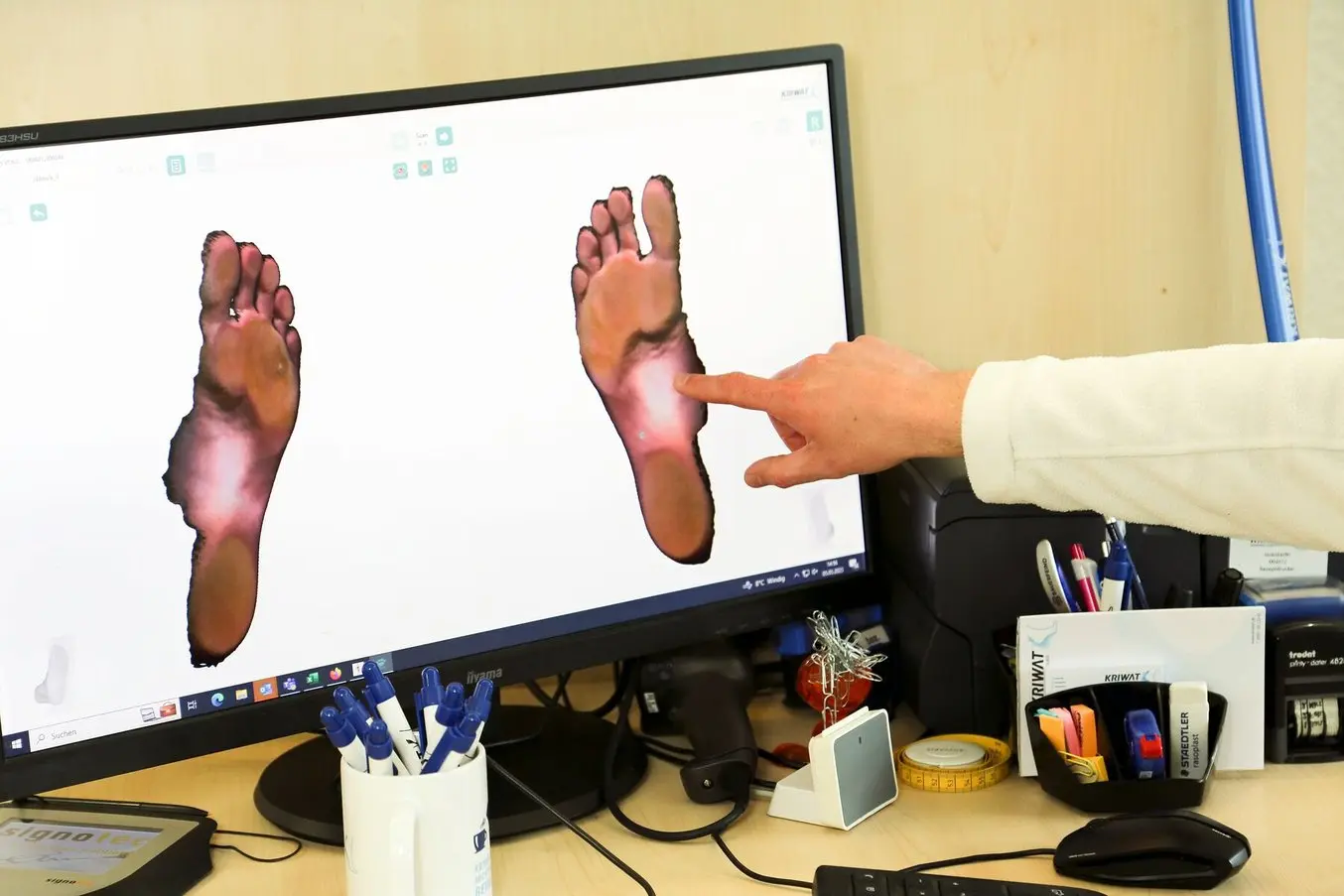 Person pointing to digital images of feet on a computer screen