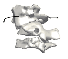 3d reconstruction of the cervical vertebra