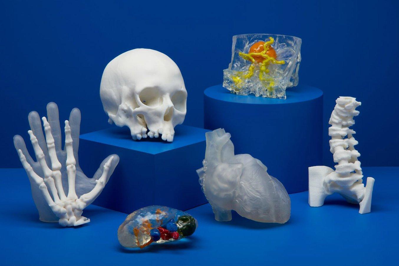 3D-gedruckte Anatomiemodelle