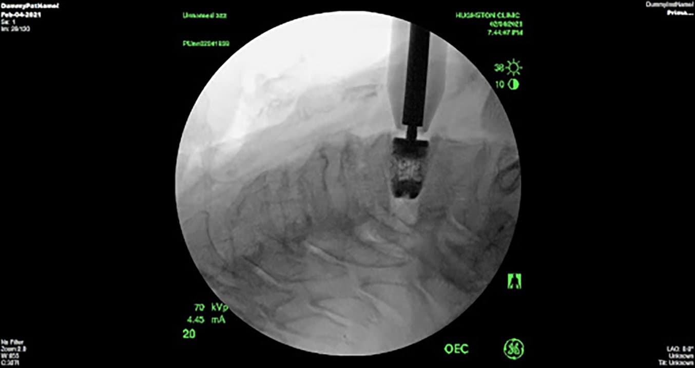 3D Printed Surgical Instruments