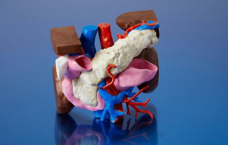 A 3D printed pancreas model c/o Drs. Decker and Ford, USF Health