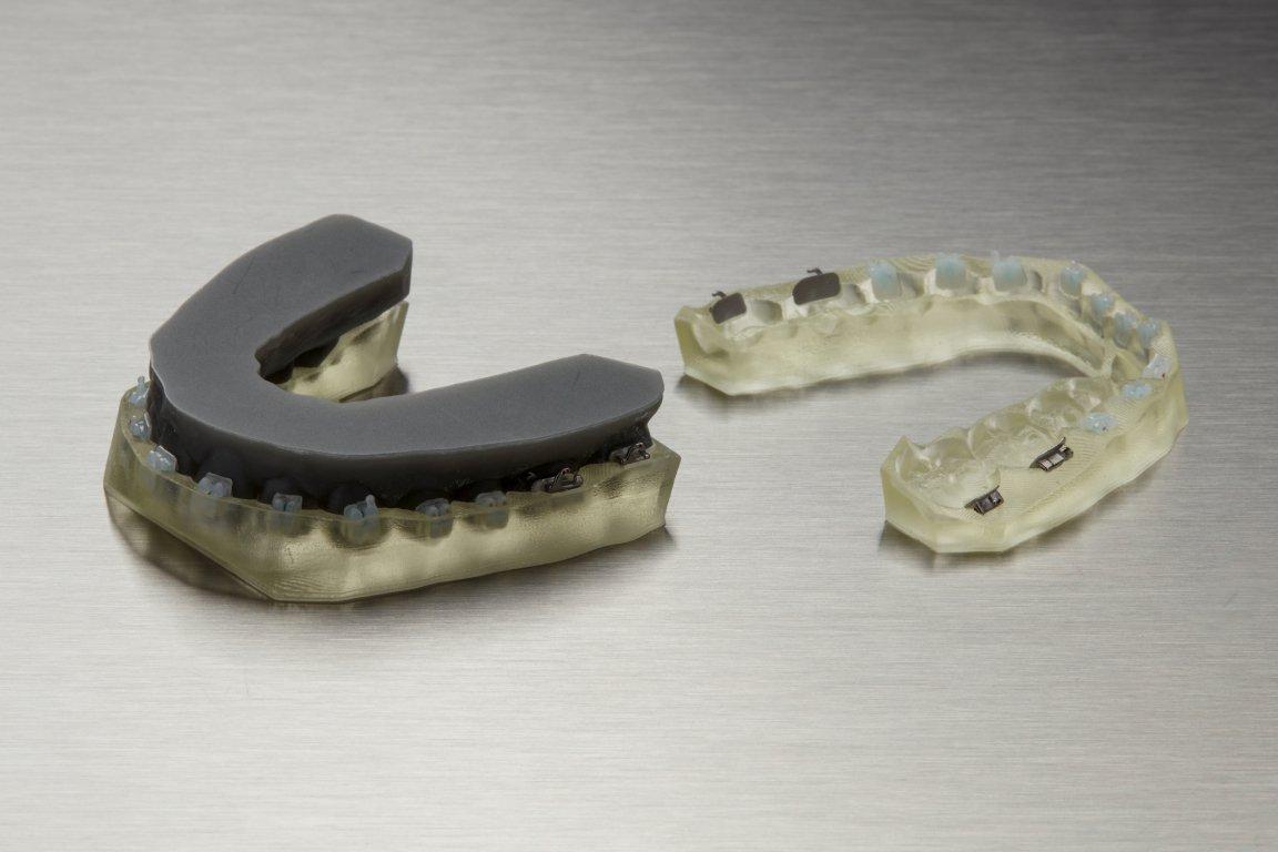 Профессиональные полимеры для 3D печати для цифровой стоматологии | Formlabs