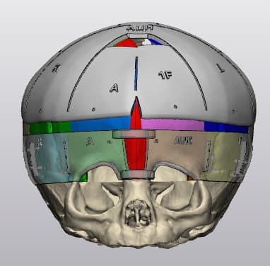 photo of a scan of a skull