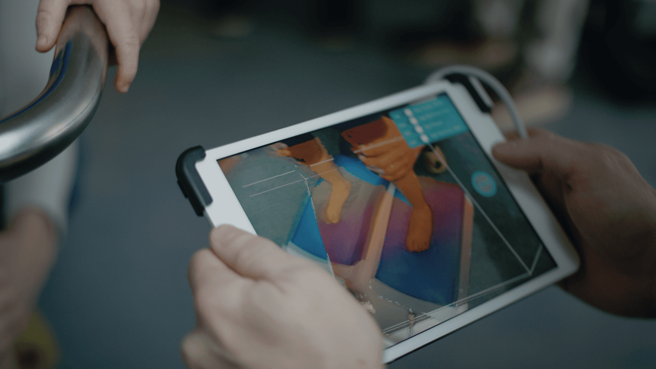 Nel workflow di Matej, i piedi del paziente vengono collocati nella posizione corretta su un sacchetto sottovuoto pieno e vengono scansionati in 3D.