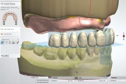 dental design