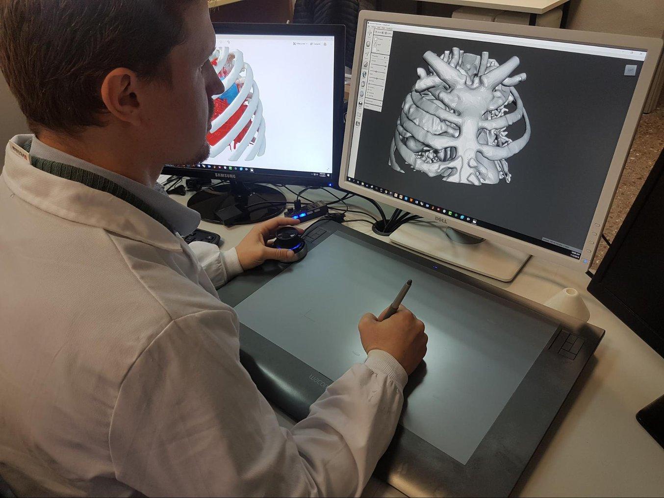 Anatomische Modelle auf Basis von CT- oder MRT-Scans eines Patienten. Die Scandaten müssen in einer Software segmentiert werden, um die wichtigen Bereiche für das 3D-Druckmodell zu isolieren.
