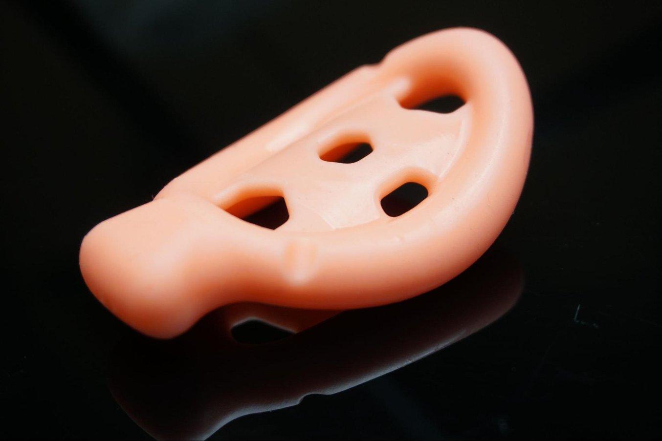 Patient-specific pessaries produced by silicone casting.