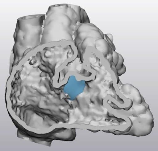 Digital model of a heart