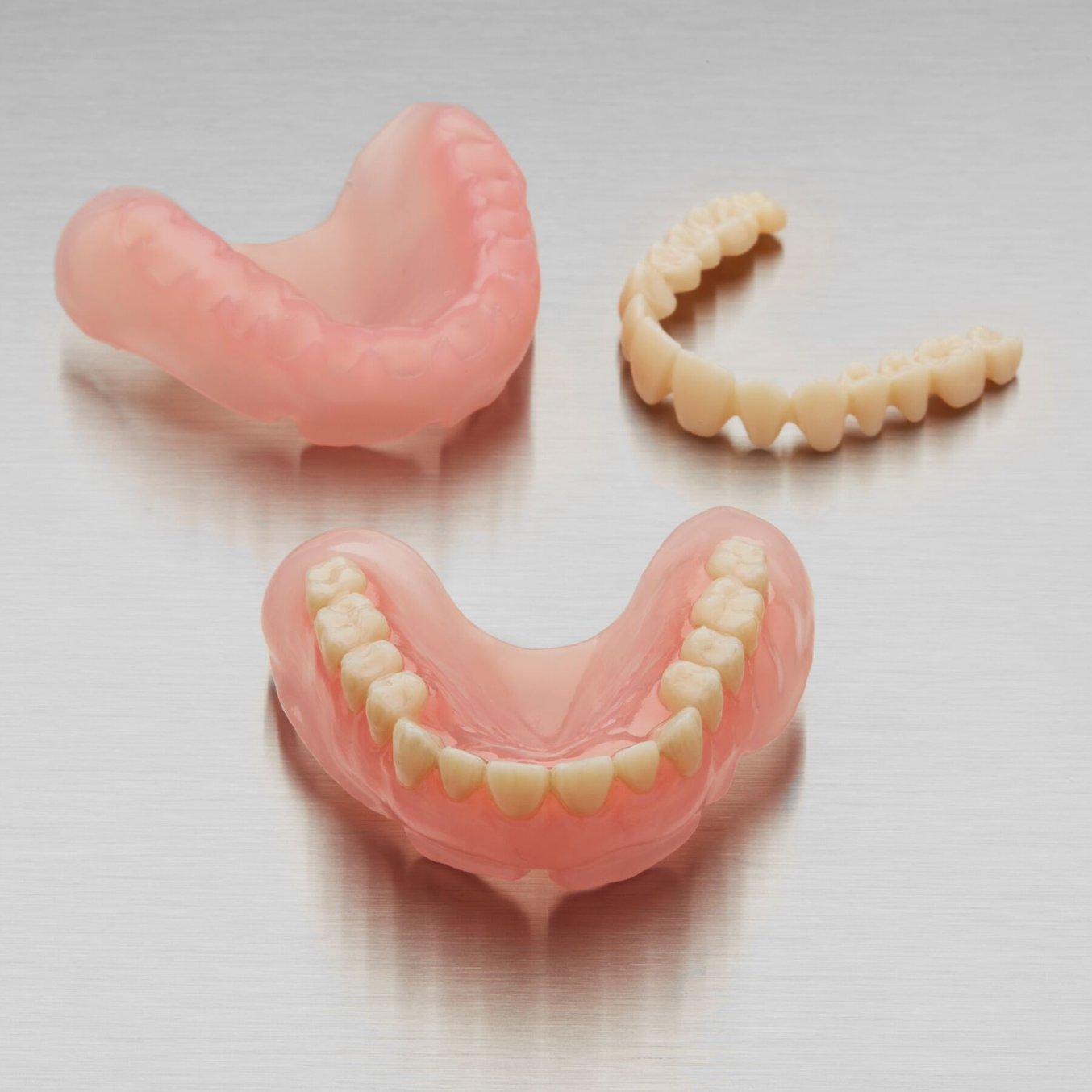 Digital Dentures - 3D printing
