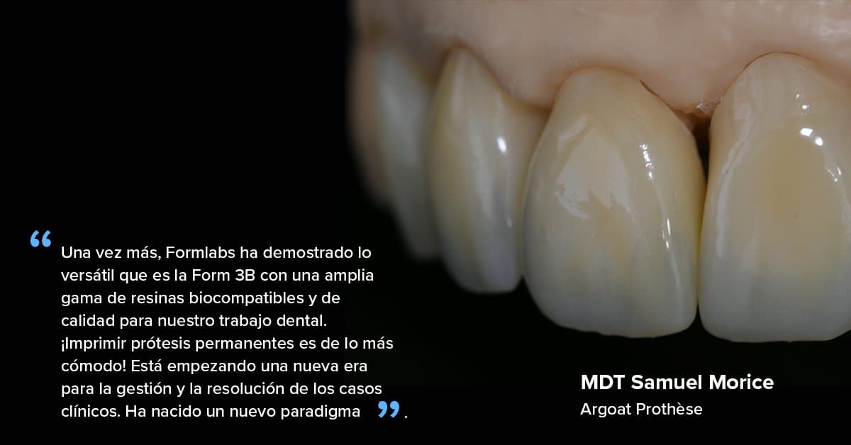 "Una vez más, Formlabs ha demostrado lo versátil que es la Form 3B con una amplia gama de resinas biocompatibles y de calidad para nuestro trabajo dental. ¡Imprimir prótesis permanentes es de lo más cómodo!"