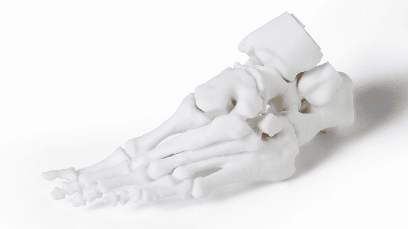 Un modèle du pied d'un patient, imprimé en 3D à partir des spécifications, utilisés pour préparer des praticiens à des cas complexes.