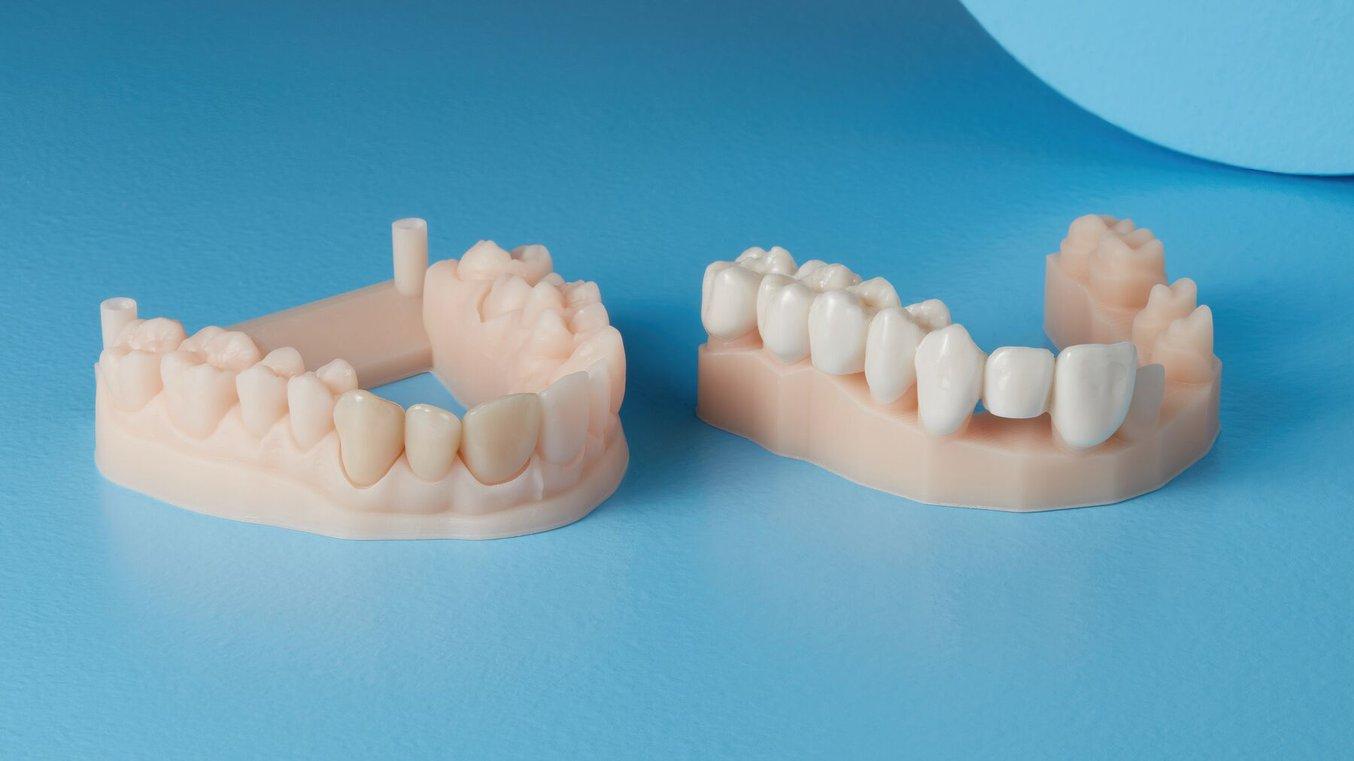 蓝色的桌子上放着两对使用 Temporary CB Resin 打印的牙冠。