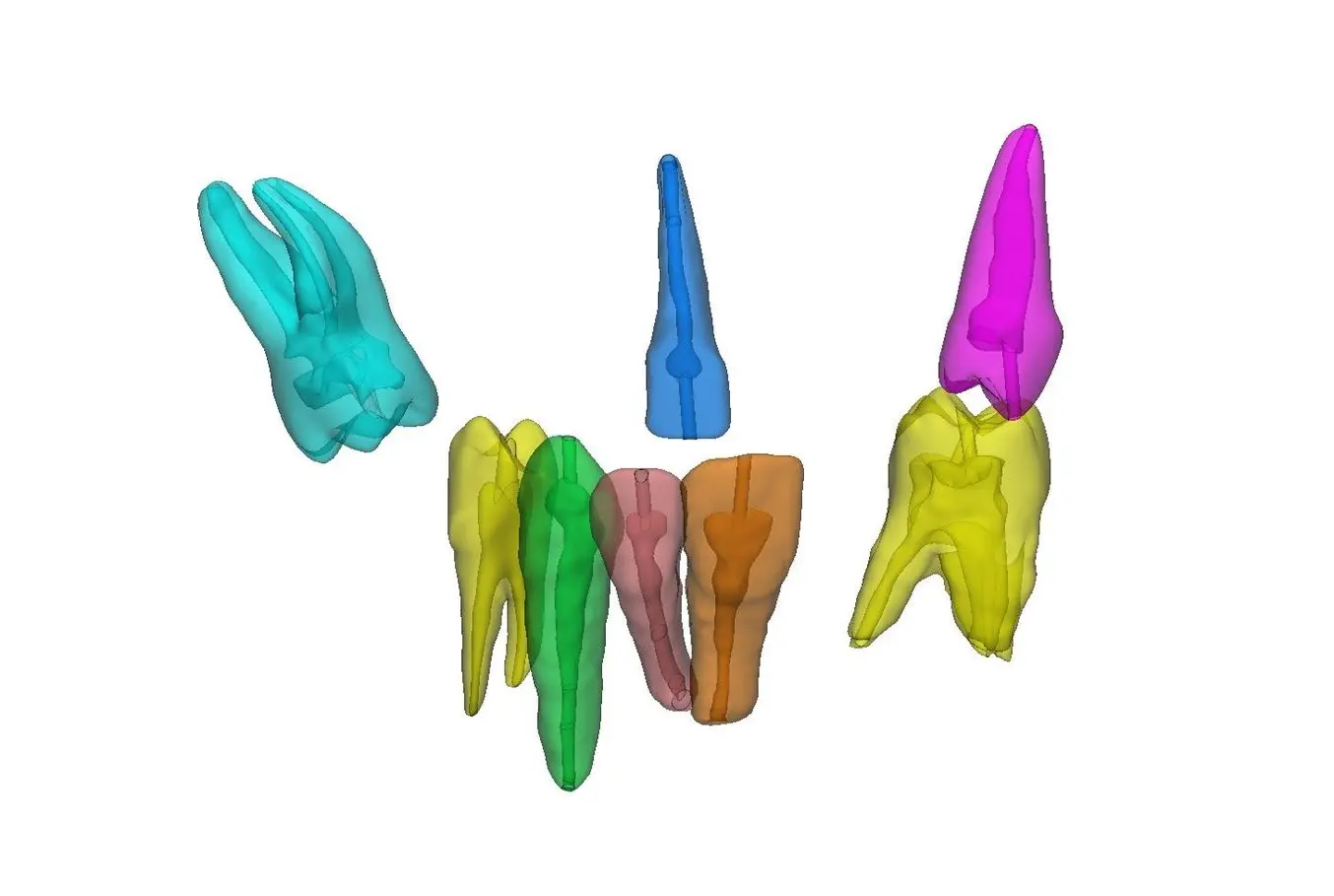 3D printing teaching aids: Screenshot of Materialise Mimics showing segmented teeth.